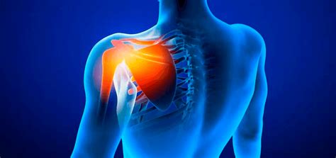 Эффективное лечение болей в суставах плеча